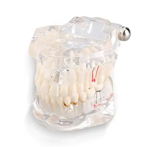 Transparentes Dental Modell für Mitarbeiter und Patienten